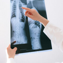 Hydrogen Therapy - Inhalation Benefits